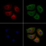 Phospho-Alpha-synuclein (Tyr133) Antibody in Immunocytochemistry (ICC/IF)