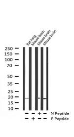 Phospho-Alpha-synuclein (Tyr133) Antibody in Western Blot (WB)