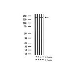 Phospho-BRCA1 (Ser1423) Antibody in Western Blot (WB)