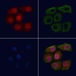 Phospho-BRCA1 (Ser1524) Polyclonal Antibody