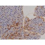 Phospho-STAT6 (Tyr641) Polyclonal Antibody
