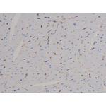 Phospho-STAT6 (Thr645) Polyclonal Antibody