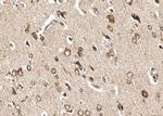 Phospho-GluR1 (Ser863) Polyclonal Antibody