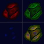 Phospho-mTOR (Ser2481) Polyclonal Antibody