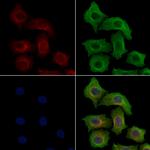 Phospho-ZAP-70 (Tyr319) Polyclonal Antibody