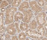 Phospho-ZAP-70 (Tyr493) Antibody in Immunohistochemistry (Paraffin) (IHC (P))