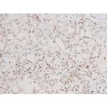 Phospho-SYK (Tyr348) Antibody in Immunohistochemistry (Paraffin) (IHC (P))