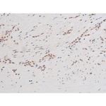 Phospho-SYK (Tyr348) Polyclonal Antibody