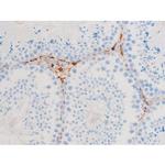 Phospho-SYK (Tyr348) Antibody in Immunohistochemistry (Paraffin) (IHC (P))