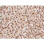 Phospho-SYK (Tyr348) Antibody in Immunohistochemistry (Paraffin) (IHC (P))