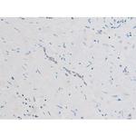 Phospho-SYK (Tyr525) Antibody in Immunohistochemistry (Paraffin) (IHC (P))