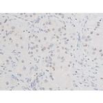 Phospho-SYK (Tyr525) Antibody in Immunohistochemistry (Paraffin) (IHC (P))