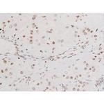 Phospho-SYK (Tyr525) Antibody in Immunohistochemistry (Paraffin) (IHC (P))