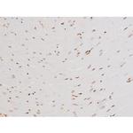 Phospho-SYK (Tyr525) Antibody in Immunohistochemistry (Paraffin) (IHC (P))