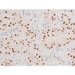 Phospho-JNK1/JNK2/JNK3 (Thr183, Tyr185) Antibody in Immunohistochemistry (Paraffin) (IHC (P))