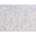 Phospho-JNK1/JNK2/JNK3 (Thr183, Tyr185) Antibody in Immunohistochemistry (Paraffin) (IHC (P))