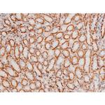 Phospho-JNK1/JNK2/JNK3 (Thr183, Tyr185) Antibody in Immunohistochemistry (Paraffin) (IHC (P))