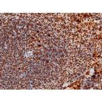 Phospho-JNK1/JNK2/JNK3 (Thr183, Tyr185) Antibody in Immunohistochemistry (Paraffin) (IHC (P))