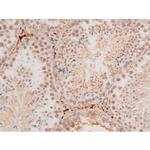 Phospho-JNK1/JNK2/JNK3 (Thr183, Tyr185) Antibody in Immunohistochemistry (Paraffin) (IHC (P))