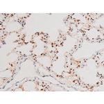 Phospho-JNK1/JNK2/JNK3 (Thr183, Tyr185) Antibody in Immunohistochemistry (Paraffin) (IHC (P))