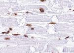 Phospho-MAP2K4 (Thr261) Antibody in Immunohistochemistry (Paraffin) (IHC (P))