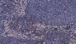 Phospho-MEK3 (Ser189) Polyclonal Antibody