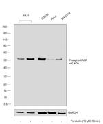 Phospho-VASP (Ser157) Antibody in Western Blot (WB)