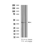 Phospho-CCR5 (Ser336) Polyclonal Antibody