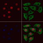 Phospho-STAT5 beta (Ser731) Polyclonal Antibody