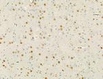 Phospho-LIMK1/LIMK2 (Thr508, Thr505) Antibody in Immunohistochemistry (Paraffin) (IHC (P))
