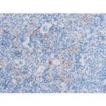 Phospho-LIMK1/LIMK2 (Thr508, Thr505) Antibody in Immunohistochemistry (Paraffin) (IHC (P))