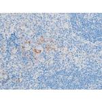 Phospho-LIMK1/LIMK2 (Thr508, Thr505) Antibody in Immunohistochemistry (Paraffin) (IHC (P))
