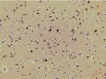 Phospho-LIMK1 (Thr508) Antibody in Immunohistochemistry (Paraffin) (IHC (P))