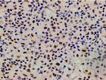 Phospho-LIMK1 (Thr508) Antibody in Immunohistochemistry (Paraffin) (IHC (P))