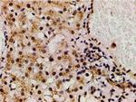 Phospho-LIMK1 (Thr508) Antibody in Immunohistochemistry (Paraffin) (IHC (P))