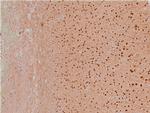 Phospho-LIMK1 (Thr508) Antibody in Immunohistochemistry (Paraffin) (IHC (P))