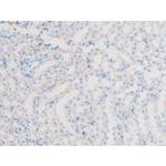 Phospho-LIMK1 (Thr508) Antibody in Immunohistochemistry (Paraffin) (IHC (P))