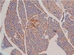 Phospho-LIMK1 (Thr508) Antibody in Immunohistochemistry (Paraffin) (IHC (P))