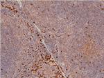 Phospho-LIMK1 (Thr508) Antibody in Immunohistochemistry (Paraffin) (IHC (P))