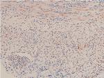 Phospho-LIMK1 (Thr508) Antibody in Immunohistochemistry (Paraffin) (IHC (P))