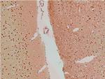Phospho-LIMK1 (Thr508) Antibody in Immunohistochemistry (Paraffin) (IHC (P))