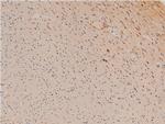Phospho-LIMK1 (Thr508) Antibody in Immunohistochemistry (Paraffin) (IHC (P))