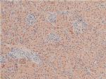 Phospho-LIMK1 (Thr508) Antibody in Immunohistochemistry (Paraffin) (IHC (P))