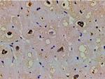 Phospho-LIMK1 (Thr508) Antibody in Immunohistochemistry (Paraffin) (IHC (P))