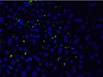 Phospho-LIMK1 (Thr508) Antibody in Immunohistochemistry (Paraffin) (IHC (P))
