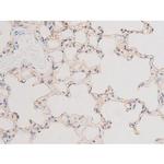 Phospho-LIMK2 (Ser283) Antibody in Immunohistochemistry (Paraffin) (IHC (P))