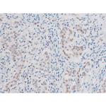 Phospho-LIMK2 (Ser283) Polyclonal Antibody
