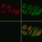 Phospho-Ataxin 1 (Ser775) Antibody in Immunocytochemistry (ICC/IF)