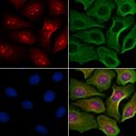 Phospho-Histone H3 (Ser11) Antibody in Immunocytochemistry (ICC/IF)