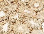 Phospho-Histone H3 (Ser11) Antibody in Immunohistochemistry (Paraffin) (IHC (P))